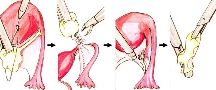 Выраженное воспаление органа