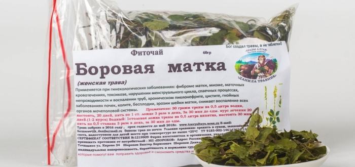 Эндометриоз